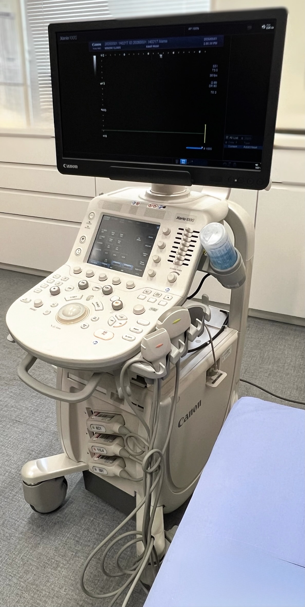 心エコー検査機器